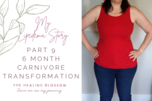 Lipedema – The Healing Blossom