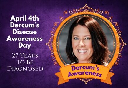April 4th is Dercum's Disease Awareness Day - 27 Year To Be Diagnosed - Sharing my story