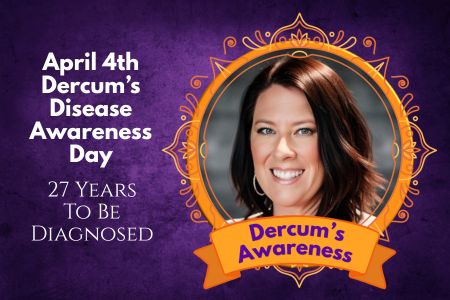 April 4th is Dercum's Disease Awareness Day - 27 Year To Be Diagnosed - Sharing my story
